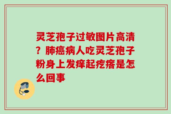灵芝孢子过敏图片高清？肺癌病人吃灵芝孢子粉身上发痒起疙瘩是怎么回事