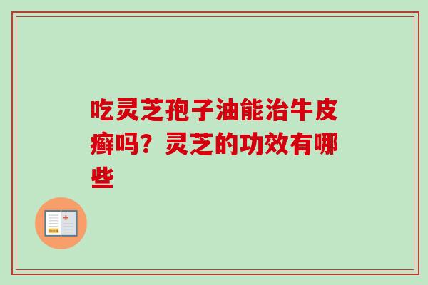吃灵芝孢子油能治牛皮癣吗？灵芝的功效有哪些