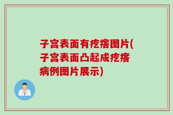 子宫表面有疙瘩图片(子宫表面凸起成疙瘩 病例图片展示)